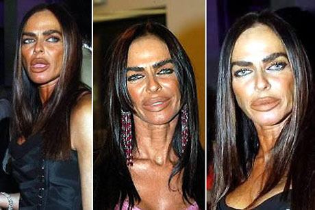 10 Worst Plastic Surgery Disasters | Daily Fun Lists | Page 10